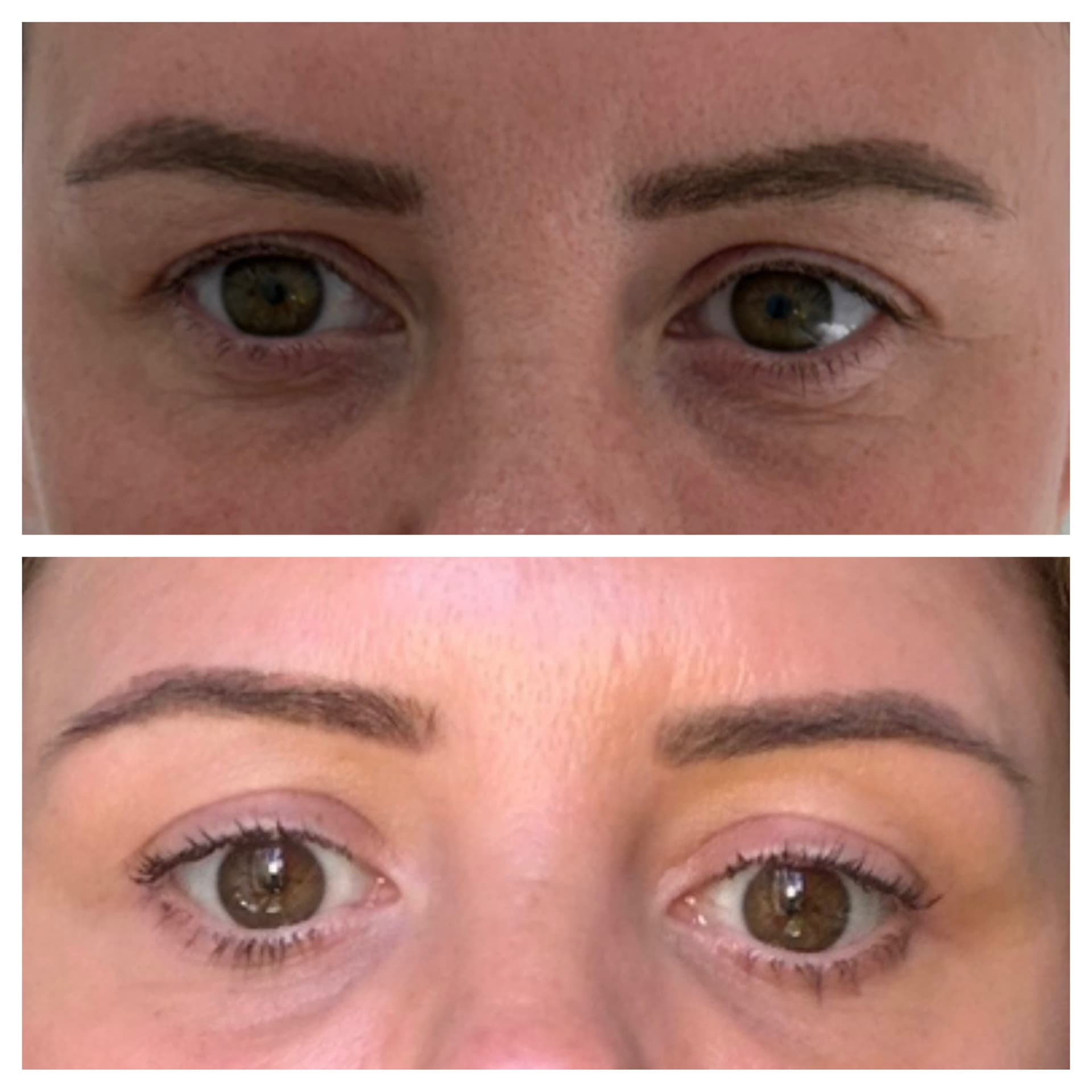 Plasma Pen clinical environment